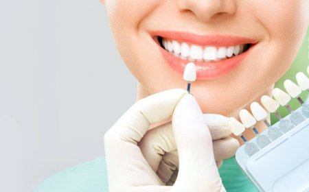 How Veneers in Dubai Can Enhance Your Smile and Self-Confidence