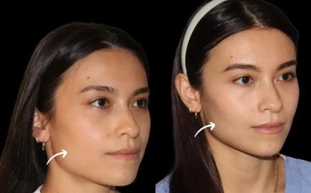 Best Aesthetic Clinics in Dubai with Documented Sculptra Fillers Results