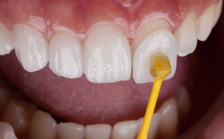 De Beste Zorg voor Kinderen: Angstbehandeling en Kindertandheelkunde in de Praktijk