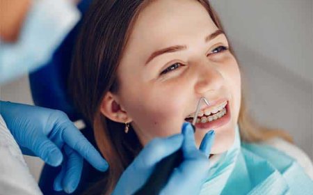 השתלת שיניים באשדוד עם רופאים מומחים ושימוש בטכנולוגיה חדשנית