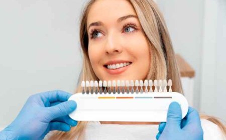 A Personalised Smile: Whitening Needs a Dentist’s Precision