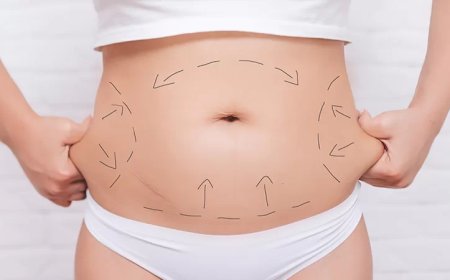 Hidden Costs in Affordable Tummy Tuck Packages in Islamabad