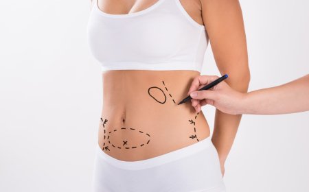 What Is the Cost of Abdominoplasty in Islamabad in 2025?